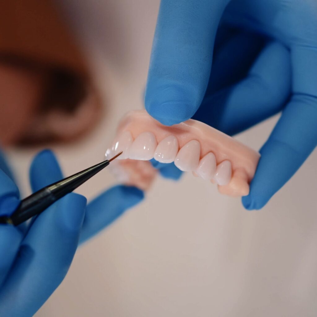 Como as facetas híbridas são produzidas