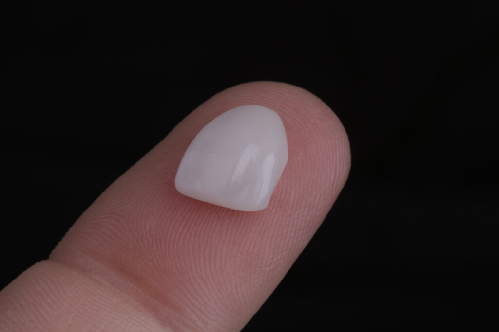 De que material são feitas as facetas híbridas